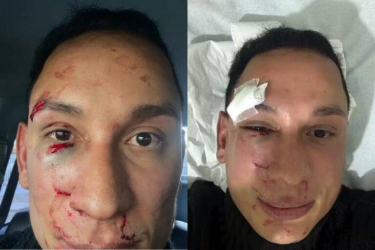 Dentista é Espancado Em Camarote Durante São João De Irecê