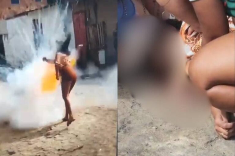 Jovem é Gravemente Ferida No Rosto Por Espada Junina Em Cruz Das Almas