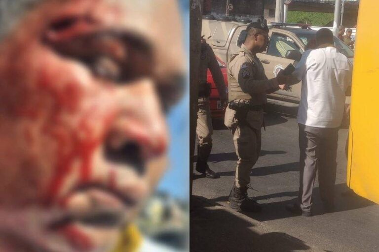 Rodoviário é Agredido Com Marteladas Em Salvador; Veja Onde