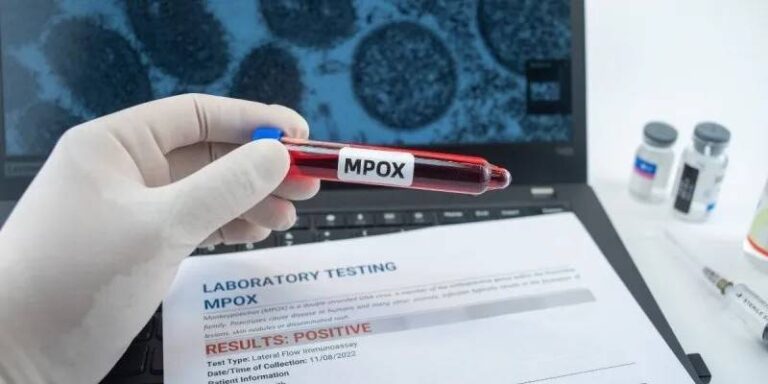 Brasil Registra 140 Casos Confirmados De Mpox